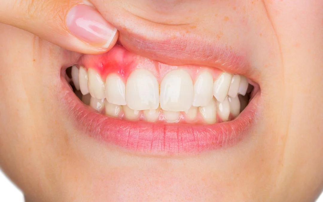 dịch vụ điều trị viêm nha chu